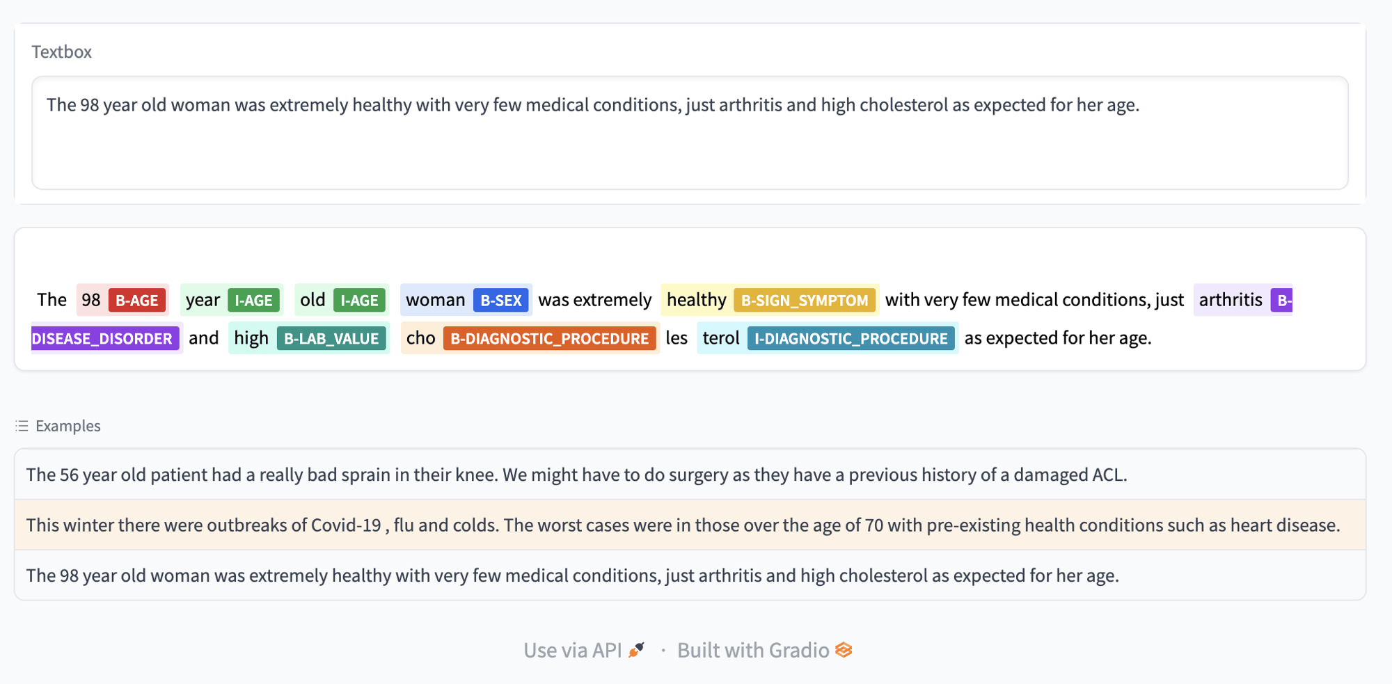 Rapidly building NLP applications with Hugging Face and IPUs