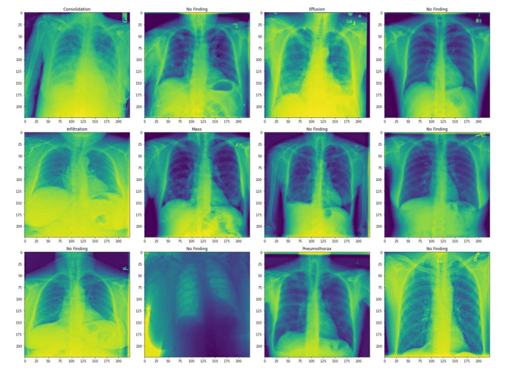 x-ray images transformed