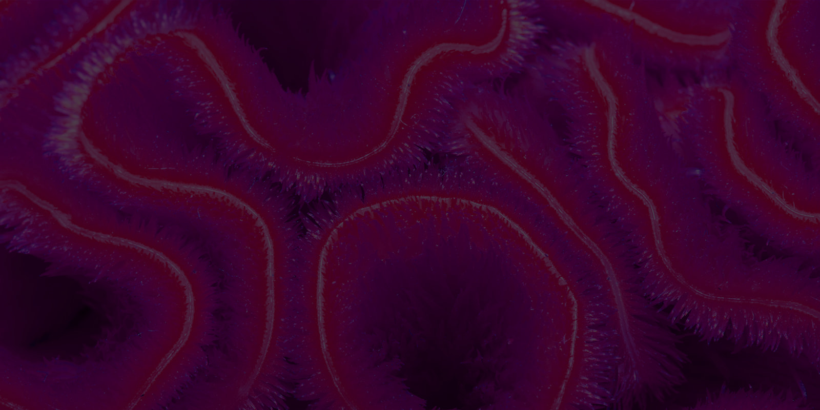 What links brains, worms and parallel processors for AI? What links brains, worms and parallel processors for AI?